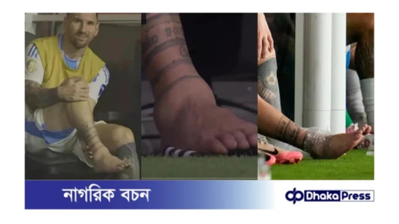 অ্যাঙ্কেলে চোট কাটিয়ে মাঠে ফিরবেন কবে মেসি?