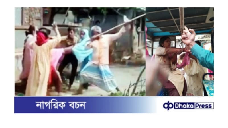 কুমিল্লার মুরাদনগরে সম্পত্তি নিয়ে বিরোধের জেরে চাচার হাতে ভাতিজি টেঁটা বিদ্ধ, ফেসবুকে তীব্র সমালোচনার ঝড়