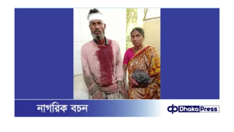 পলাশবাড়ীতে জমিতে সেচপাম্পের পানি সরবরাহকে কেন্দ্র করে মারপিটে আহত ৮
