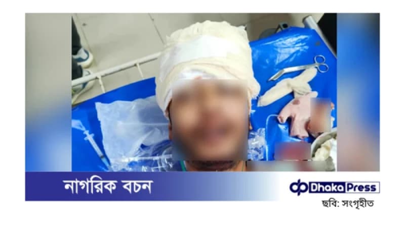 কক্সবাজার বিমান ঘাঁটিতে অতর্কিত হামলা, গুলিতে তরুণ নিহত