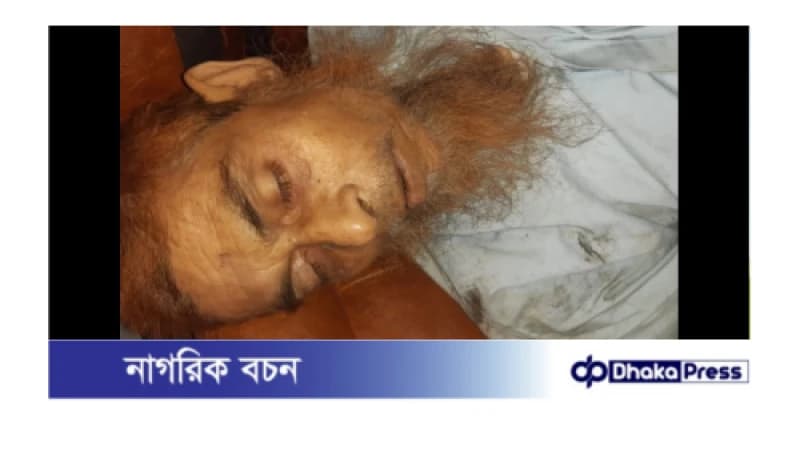 সীতাকুণ্ডের বাঁশবাড়িয়ায় সড়ক দূর্ঘটনায় মসজিদের ইমাম নিহত