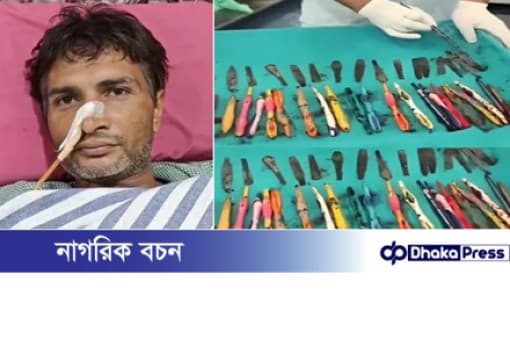 এক যুবকের পেট থেকে উদ্ধার হলো অদ...