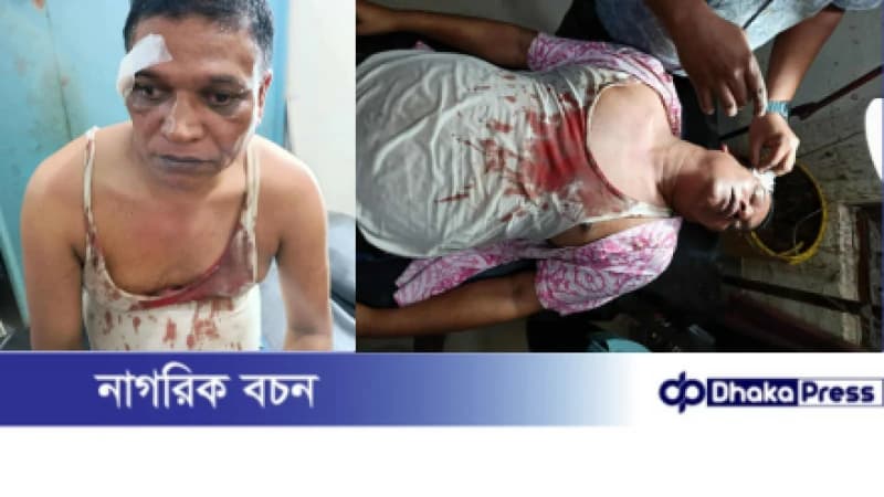 সীতাকুণ্ড প্রেসক্লাবের সাবেক সেক্রেটারী  লিটন চৌধুরীর উপর হামলা, মব সৃষ্টির চেষ্টা