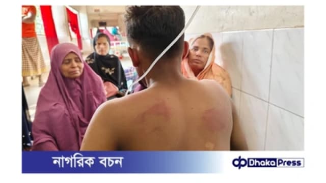 কুষ্টিয়ায় চুরির অভিযোগে দুই কিশোরকে রাতভর নির্যাতন, সকাল...