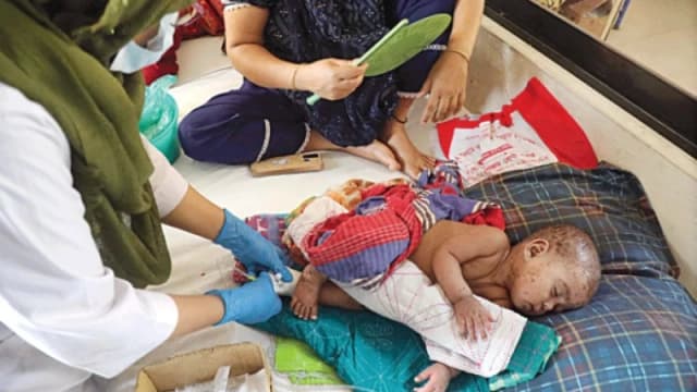 ঊর্ধ্বমুখী হামের সংক্রমণ, বাড়ছে...