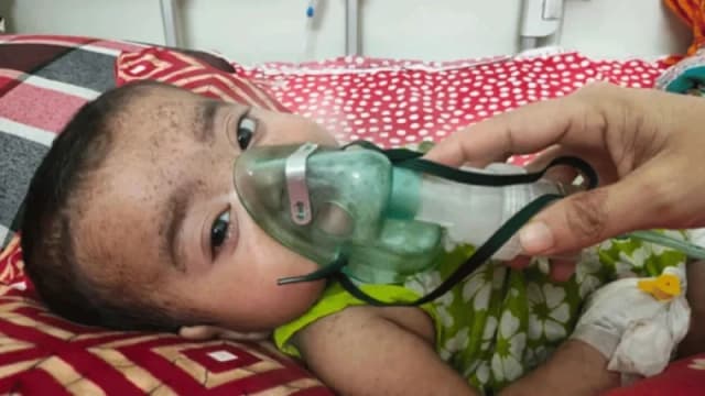 হাম ও উপসর্গে আরও ১৩ শিশুর মৃত্য...
