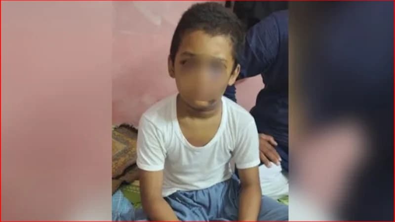 খুলনায় মাদ্রাসায় মারধরের ঘটনায় শিশুর মস্তিষ্কে রক্তক্ষরণ, শিক্ষক পলাতক