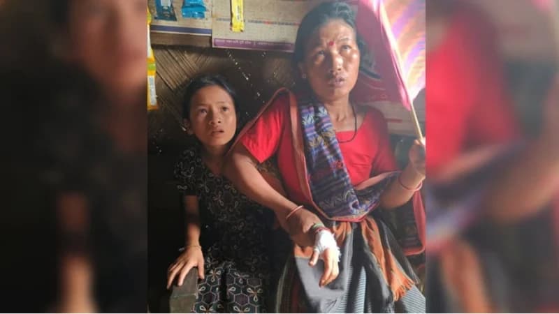 বাঘাইছড়িতে দুই পক্ষের গোলাগুলিতে ৮ বছরের শিশু গুলিবিদ্ধ