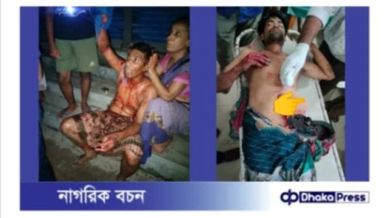নাটোরের সিংড়ায় বাসার ভিতরে দুই যুবককে কুপিয়ে জখম নাটোরের সিংড়ায় বাসার ভিতরে দুই যুবককে কুপিয়ে জখম