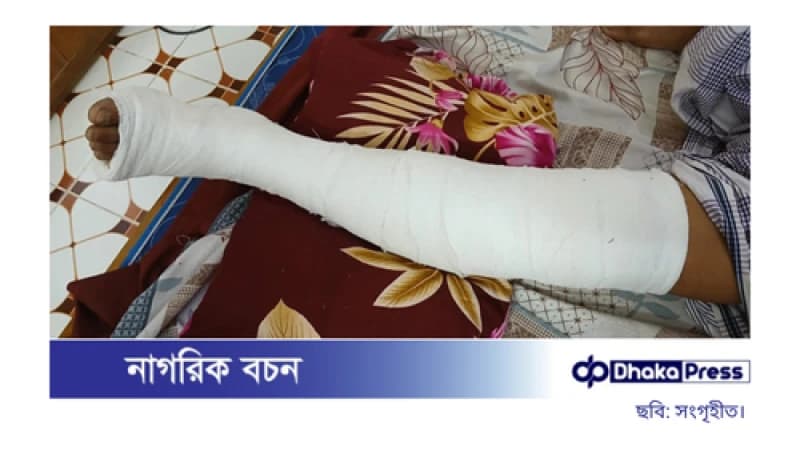 সালথায় চাঁদার টাকা না দেওয়ায় সাবেক পুলিশ সদস্যকে কুপিয়ে জখম সালথায় চাঁদার টাকা না দেওয়ায় সাবেক পুলিশ সদস্যকে কুপিয়ে জখম