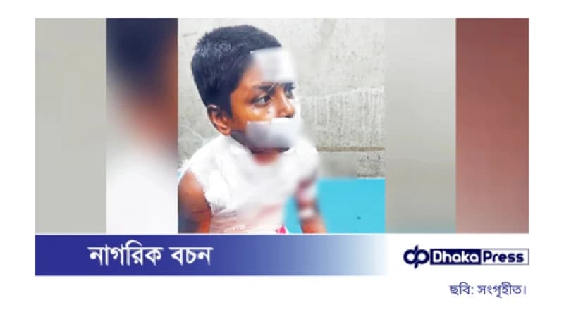 নির্মমতার শিকার শিশু রাব্বী: শরীরজুড়ে ব্লেডের আঘাত নির্মমতার শিকার শিশু রাব্বী: শরীরজুড়ে ব্লেডের আঘাত