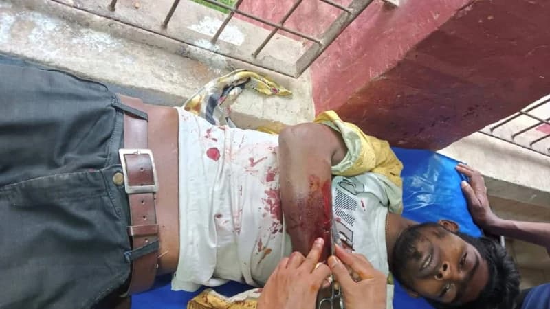 পুঠিয়ায় কুপিয়ে জখম করে ছিনতাই পুঠিয়ায় কুপিয়ে জখম করে ছিনতাই
