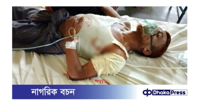 কুড়িগ্রামে আঃলীগ নেতাকে প্রকাশ্যে কোপালো যুবদল কর্মীরা কুড়িগ্রামে আঃলীগ নেতাকে প্রকাশ্যে কোপালো যুবদল কর্মীরা