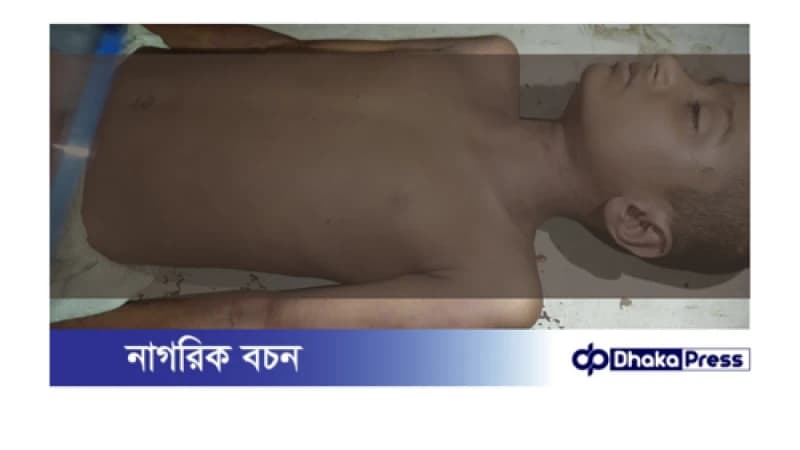 হত্যা নাকি আত্যহত্যা সংবাদ প্রকাশে সাংবাদিকদের বাঁধা আরেক সাংবাদিক-মোফাস্সেলকে মারা হয়েছে বলে দাবি করেন স্বজনরা। হত্যা নাকি আত্যহত্যা সংবাদ প্রকাশে সাংবাদিকদের বাঁধা আরেক সাংবাদিক-মোফাস্সেলকে মারা হয়েছে বলে দাবি করেন স্বজনরা।