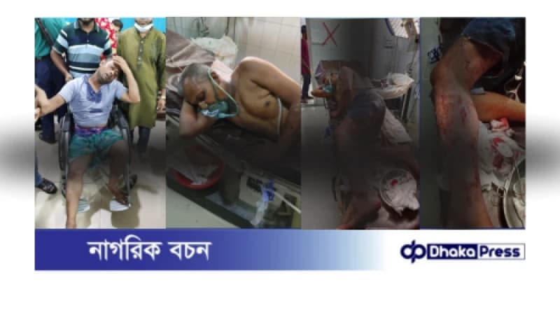 নগর ভবনে ইশরাকের সমর্থকদের হাতে বিরোধীদের মারধর, সাংবাদিককে হুমকি: এক উত্তপ্ত পরিস্থিতি নগর ভবনে ইশরাকের সমর্থকদের হাতে বিরোধীদের মারধর, সাংবাদিককে হুমকি: এক উত্তপ্ত পরিস্থিতি