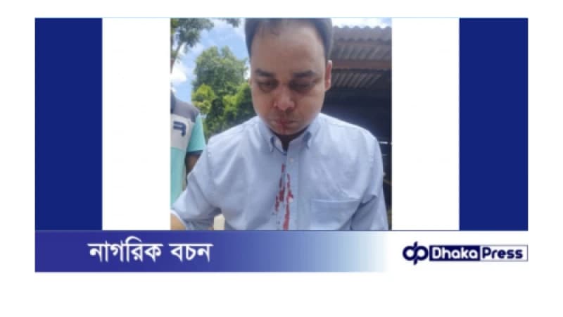 কুড়িগ্রামে দুর্বৃত্তদের হামলায় উপজেলা স্বাস্থ্য কমপ্লেক্সের ফার্মাসিস্ট আহত কুড়িগ্রামে দুর্বৃত্তদের হামলায় উপজেলা স্বাস্থ্য কমপ্লেক্সের ফার্মাসিস্ট আহত