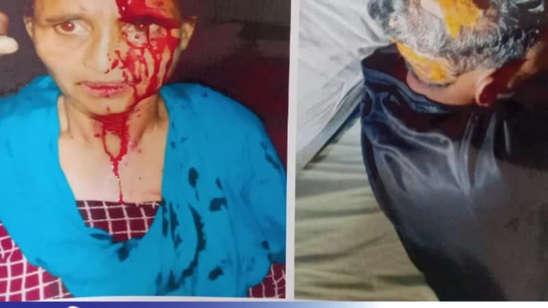 মাদারগঞ্জে ছিনতাই-বিদেশি চাইনিজ কুড়াল দিয়ে মাথায় আঘাত। মাদারগঞ্জে ছিনতাই-বিদেশি চাইনিজ কুড়াল দিয়ে মাথায় আঘাত।