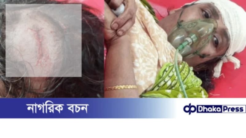 সোনারগাঁয়ে গনকবাড়ী এলাকায় জোরপূর্বক রাস্তা দখলকে কেন্দ্র করে মহিলাসহ আহত ৩, কুপিয়ে রক্তাক্ত জখম সোনারগাঁয়ে গনকবাড়ী এলাকায় জোরপূর্বক রাস্তা দখলকে কেন্দ্র করে মহিলাসহ আহত ৩, কুপিয়ে রক্তাক্ত জখম