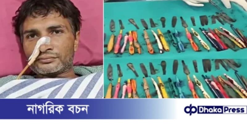 এক যুবকের পেট থেকে উদ্ধার হলো অদ্ভুত সামগ্রী এক যুবকের পেট থেকে উদ্ধার হলো অদ্ভুত সামগ্রী