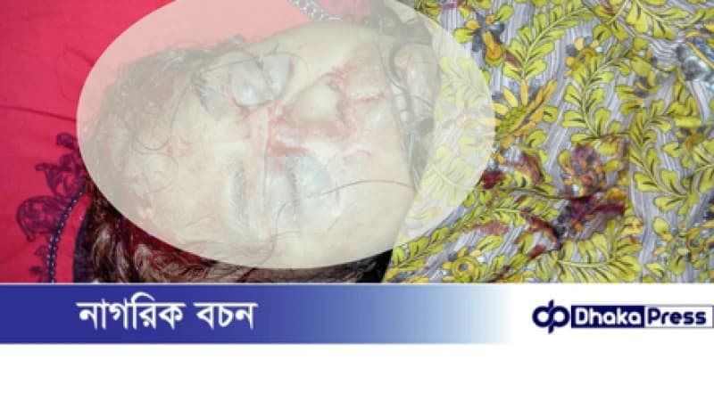 বড়াইগ্রামে বৃদ্ধাকে মুখমণ্ডল থেতলে হত্যা করেছে দুর্বৃত্তরা বড়াইগ্রামে বৃদ্ধাকে মুখমণ্ডল থেতলে হত্যা করেছে দুর্বৃত্তরা