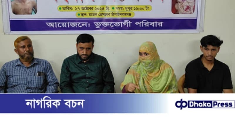 চাঁপাইনবাবগঞ্জে জুম্মার নামাজ শেষে মসজিদ থেকে তুলে নিয়ে মারধর, উল্টো থানায় মিথ্যা অভিযোগ—প্রতিবাদে সংবাদ সম্মেলন চাঁপাইনবাবগঞ্জে জুম্মার নামাজ শেষে মসজিদ থেকে তুলে নিয়ে মারধর, উল্টো থানায় মিথ্যা অভিযোগ—প্রতিবাদে সংবাদ সম্মেলন
