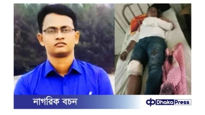 সড়কে গাছ ফেলে ডাকাতি: খবর পেয়ে অভিযানে গিয়ে দুর্বৃত্তদের হামলায় আহত পুলিশ কর্মকর্তা সড়কে গাছ ফেলে ডাকাতি: খবর পেয়ে অভিযানে গিয়ে দুর্বৃত্তদের হামলায় আহত পুলিশ কর্মকর্তা