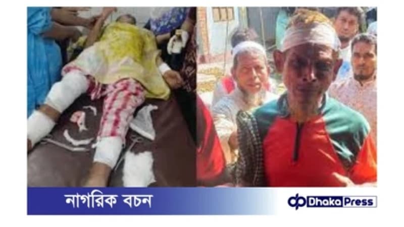 নারায়ণগঞ্জে আ. লীগ-বিএনপি সংঘর্ষ: আহত ১৫ নারায়ণগঞ্জে আ. লীগ-বিএনপি সংঘর্ষ: আহত ১৫