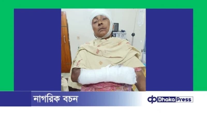 রৌমারীতে শাশুড়িকে কুপিয়ে গুরুতর জখম, জামাই পলাতক রৌমারীতে শাশুড়িকে কুপিয়ে গুরুতর জখম, জামাই পলাতক
