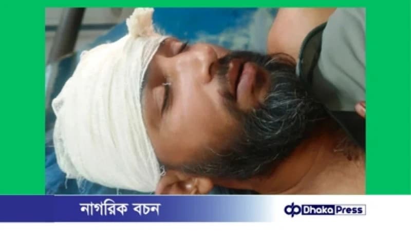 পরিচিতদের গুলিতে এনসিপি নেতা মোতালেব শিকদার আহত, পুলিশের প্রাথমিক ধারণা পরিচিতদের গুলিতে এনসিপি নেতা মোতালেব শিকদার আহত, পুলিশের প্রাথমিক ধারণা