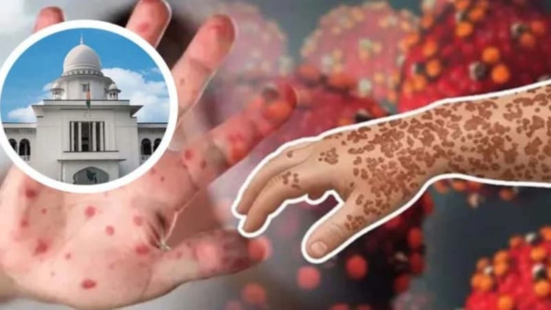 হামে মৃত ৩৫২ শিশুর পরিবারকে ২ কোটি টাকা করে ক্ষতিপূরণ দিতে রিট হামে মৃত ৩৫২ শিশুর পরিবারকে ২ কোটি টাকা করে ক্ষতিপূরণ দিতে রিট