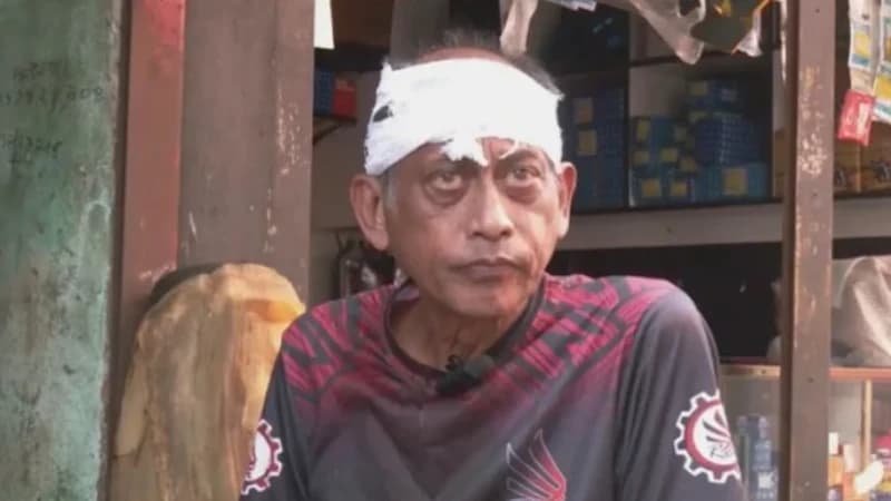 যশোরে অভিনেতা সমু চৌধুরীর মাথা ফাটালেন গ্যারেজ মালিক ও মেকানিক যশোরে অভিনেতা সমু চৌধুরীর মাথা ফাটালেন গ্যারেজ মালিক ও মেকানিক