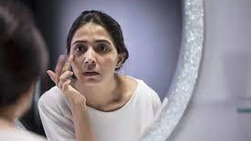 যেভাবে বুঝবেন ত্বক আর্দ্রতা হারাচ্ছে যেভাবে বুঝবেন ত্বক আর্দ্রতা হারাচ্ছে