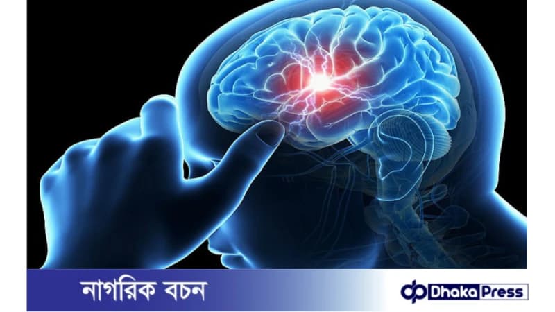 স্ট্রোক হওয়ার কারণ ও লক্ষণ স্ট্রোক হওয়ার কারণ ও লক্ষণ