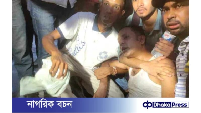 এফডিসিতে শিল্পীদের সাংবাদিকদের উপর হামলা: ১০ জন আহত এফডিসিতে শিল্পীদের সাংবাদিকদের উপর হামলা: ১০ জন আহত