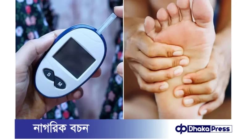 ডায়াবেটিক ফুট: লক্ষণ, প্রতিরোধ ও চিকিৎসা ডায়াবেটিক ফুট: লক্ষণ, প্রতিরোধ ও চিকিৎসা