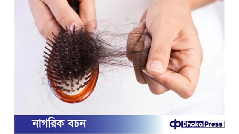 চুল পড়ার সমস্যা সমাধানে, যেসব নিয়ম মেনে চলতে হবে চুল পড়ার সমস্যা সমাধানে, যেসব নিয়ম মেনে চলতে হবে