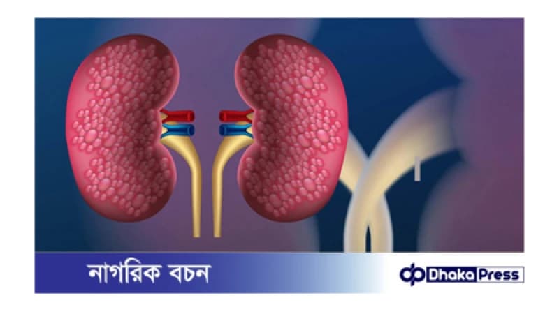 কিডনি ভালো রাখে যে ফল কিডনি ভালো রাখে যে ফল