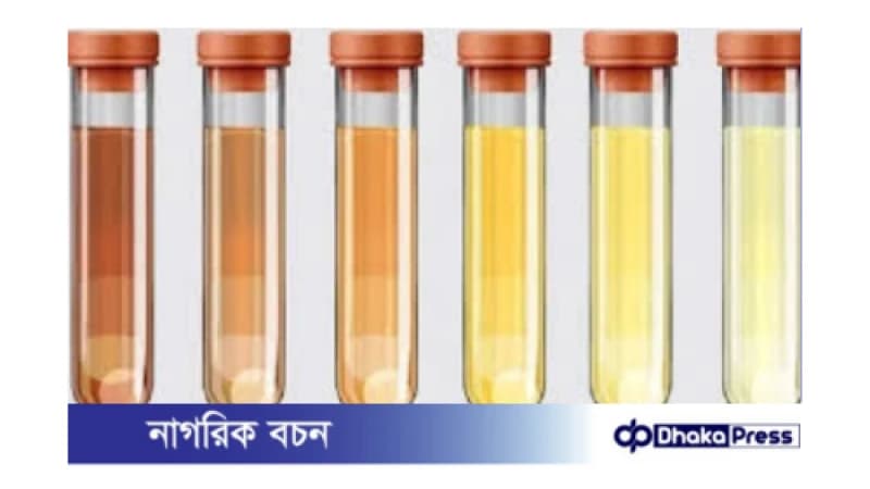 প্রস্রাবের রঙ বিভিন্ন কারণে পরিবর্তিত হতে পারে। কিছু কারণ সাধারণ এবং চিন্তার কোন কারণ নেই, আবার কিছু কারণ গুরুতর স্বাস্থ্য সমস্যার ইঙ্গিত দিতে পারে। প্রস্রাবের রঙ বিভিন্ন কারণে পরিবর্তিত হতে পারে। কিছু কারণ সাধারণ এবং চিন্তার কোন কারণ নেই, আবার কিছু কারণ গুরুতর স্বাস্থ্য সমস্যার ইঙ্গিত দিতে পারে।