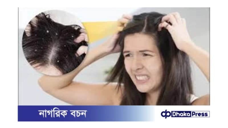 বর্ষায় মাথার ত্বকে চুলকানি: কারণ ও সমাধান বর্ষায় মাথার ত্বকে চুলকানি: কারণ ও সমাধান